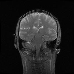 http://zhurnaly.com/images/MRI/B0015.jpg