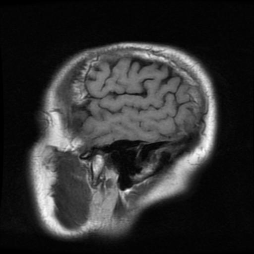 http://zhurnaly.com/images/MRI/B0026.jpg