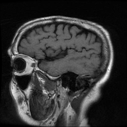 http://zhurnaly.com/images/MRI/B0047.jpg