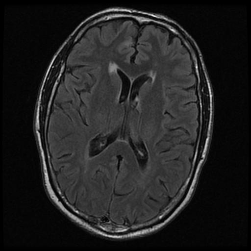 http://zhurnaly.com/images/MRI/B0105.jpg