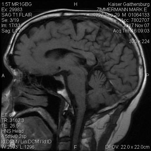 http://zhurnaly.com/images/MRI/z50018.jpg